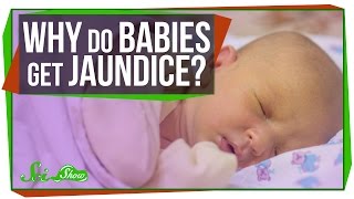 Why Do Newborn Babies Get Jaundice [upl. by Herv444]