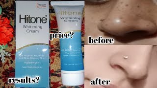 hitone whitening cream  best medicated cream for skin brightening amp freckles  pigmentation [upl. by Merrily]