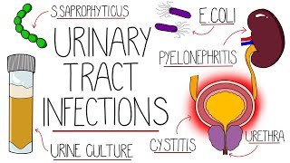 UTI Made Easy  Urinary Tract Infections Explained Clearly [upl. by Enyaw]