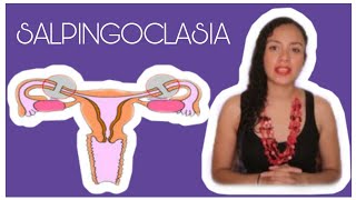 SALPINGOCLASIA ESTERILIZACIÓN FEMENINA OTB CUIDADOS ¿ES REVERSIBLE 🤰 [upl. by Yrrol]