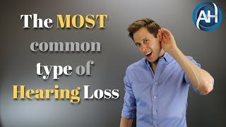 What is Sensorineural Hearing Loss  Ear Problems [upl. by Harry235]