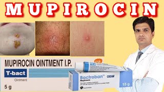 T bact ointment  Bactroban ointment  Mupirocin ointment uses side effects how to apply [upl. by Odette]