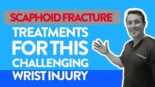 Scaphoid fracture Treatments for this challenging wrist injury [upl. by Innattirb]