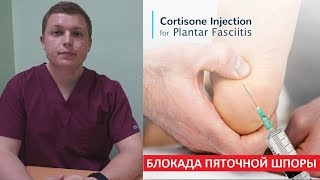 Блокада пяточной шпоры  Plantar Fasciitis Injection Treatment [upl. by Hgielrak]