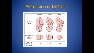 GYNECOLOGIE Présentation du front [upl. by Wehrle]