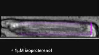 cardiac myocyte contractility [upl. by Naedan]