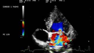 endocardite mitralica con controllo mitral endocarditis dog [upl. by Kopple]