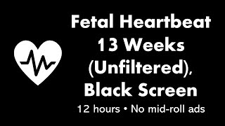 Fetal Heartbeat  13 Weeks Unfiltered 💓⬛ • 12 hours • No midroll ads [upl. by Anevad]