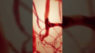 Sickle cell disease animation  sicklecelldisease SickleCellAnemia hemolysis medicalanimation [upl. by Mokas96]