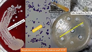 Staphylococcus aureus golden yellow colonies Gram stain Coagulase test Growth on MSA and AST [upl. by Buskirk]