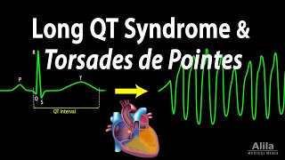 Long QT Syndrome and Torsades de Pointes Animation [upl. by Nork]