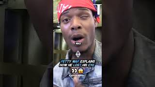 Fetty Wap EXPLAINS how he LOST His EYE 👀 [upl. by Dwight]