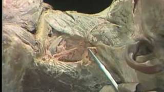 Dissection Superficial Cervical Region and Posterior Triangle of Neck [upl. by Hullda]