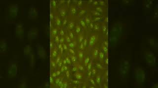 ANA Antinuclear antibody positive reaction by using indirect immunofluorescence test [upl. by Onirotciv]