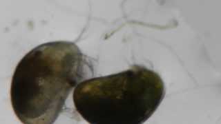 Ostracod live under the scope [upl. by Olav]