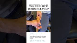 Scaphoid Tubercle Tenderness Test  Scaphoid Fracture Diagnosis [upl. by Pomcroy633]