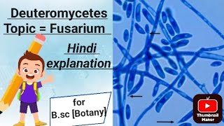 Topic  Fusarium  for Bsc Botany [upl. by Latoye959]