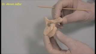 Osteology of the thoracic cage Thoracic vertebrae [upl. by Gnagflow]