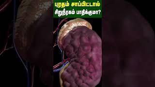 புரதம் சாப்பிட்டால் சிறுநீரகம் பாதிக்குமா  Does eating protein affect the kidney  Dr Arunkumar [upl. by Llennoj782]