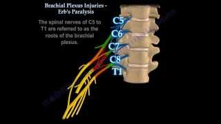 Brachial Plexus Injuries Erbs Paralysis  Everything You Need To Know  Dr Nabil Ebraheim [upl. by Eidak]