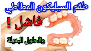 طقم الأسنان المطاطي المرن السيليكون فاشل ❗️إليكم البديل prothèse dentaire amovible Flexible [upl. by Urial474]