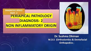 Periapical Pathology  Non inflammatory and non odontogenic lesions [upl. by Dollar244]