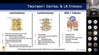 Neurogenic Claudication amp Lateral Recess Stenosis  Rick Lang MD on August 15 2022 [upl. by Meedan]