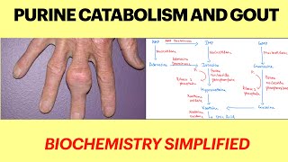 Purine catabolism and Gout  purine degradation pathway Gout biochemistry Purine metabolism  MBBS [upl. by Indira]