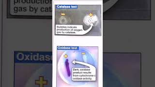 Catalase and oxidase test [upl. by Reinold]