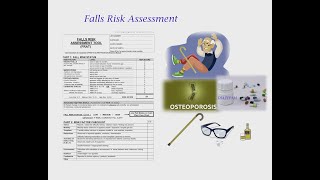 FALL RISK ASSESSMENT FOR OSCE [upl. by Jonell324]