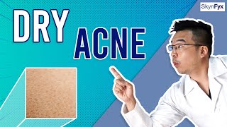 How to TREAT ACNE WHEN YOU HAVE DRY SKIN Dr Dray [upl. by Nicky663]