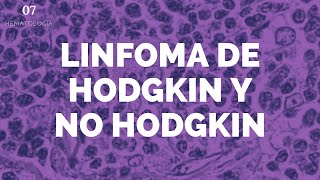 Linfoma de Hodgkin y no Hodgkin  ENARM [upl. by Assyla903]