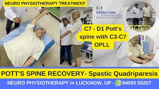 Potts Spine Physiotherapy Rehab  Best Exercises for Potts Spine  TB of Spine  Extra Care Lko [upl. by Kobi165]