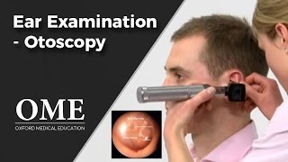 Otoscopy Ear Examination  ENT [upl. by Wenoa]