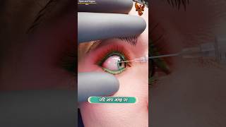 How Eye Tattooing Works 😧  आँख का टैटू कैसे किया जाता है  shorts [upl. by Aynav]