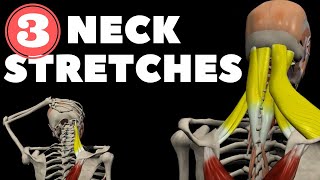 Neck Stretches for Instant pain relief [upl. by Anor916]