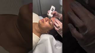 Tiefenreinigung Mit Liebe zum Detail Kosmetiksalon Berlin💆🏽‍♀️ skincare deepclean shortsvideo [upl. by Launce]