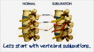 How do chiropractic adjustments work  Back to Health Wellness Centre Ottawa ON [upl. by Aztilem]