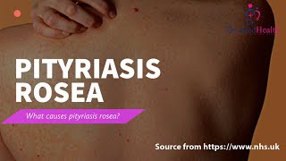 All about pityriasis rosea  causes symptoms pityriasis  pityriasis rosea treatment [upl. by Riella]