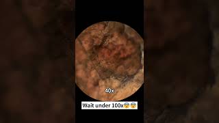 Would you still eat beef after seeing it magnified 400 times under a microscopemicroscope shorts [upl. by Rahab793]