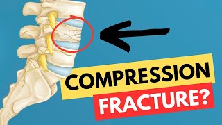 Compression Fracture How it happens what is it [upl. by Flanders]