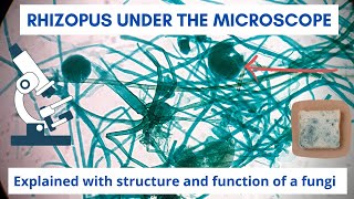 Rhizopus Nigricans Bread mold under the microscope  Fungi structure and function [upl. by Veronica962]