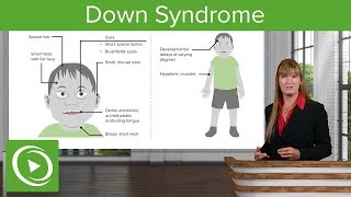 Down Syndrome – Genetics  Lecturio [upl. by Raquel]