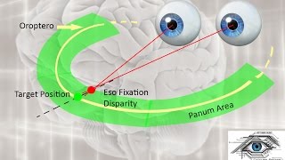 What is Fixation Disparity  Sub  ENG   Fixation Disparity part1 [upl. by Theodosia]