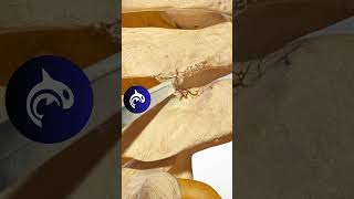 See how a Posterior Cervical Foraminotomy of the Spine works  3D Animation [upl. by Rabiah871]