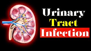 Urinary Tract Infection  Overview signs and symptoms pathophysiology causes and treatment [upl. by Esirehc]