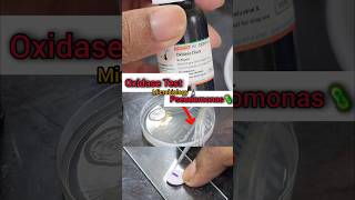 Oxidase Test 🧫🧪🔬🦠 Biochemicaltest  Microbiology Lab  Basics biochemistry shorts microbiology [upl. by Maeve]