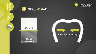 Einfach erklärt Was ist WAK in Zusammenhang mit der Zahntechnik [upl. by Sakul]