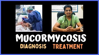 MUCORMYCOSIS Clinical features Diagnosis amp Treatment [upl. by Assirod]