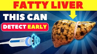 The Best 3 Tests to Detect Fatty Liver Early  Fatty Liver fattyliver health [upl. by Annoiek458]